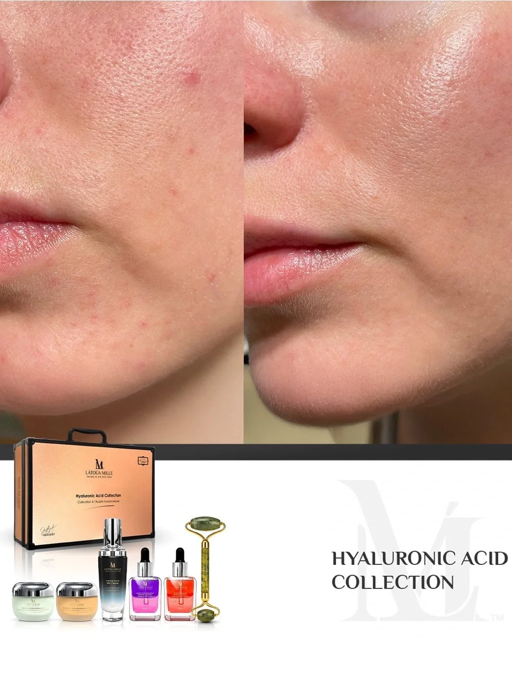 LATOUA MILLE Hyaluronic Acid Collection 6-Piece Luxury Skincare Gift Set